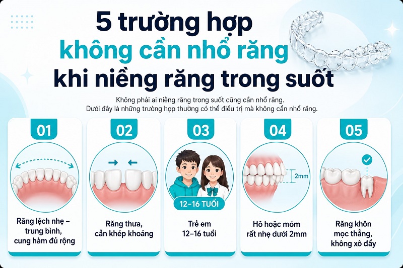 Trường hợp không cần nhổ răng khi niềng trong suốt