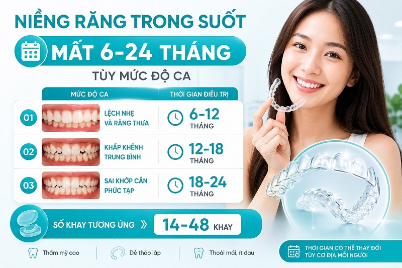 Niềng răng trong suốt mất 6-24 tháng tùy mức độ ca: