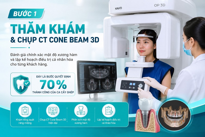 Bước 1 trong quá trình cấy ghép Implant là thăm khám tổng quát kết hợp chụp CT