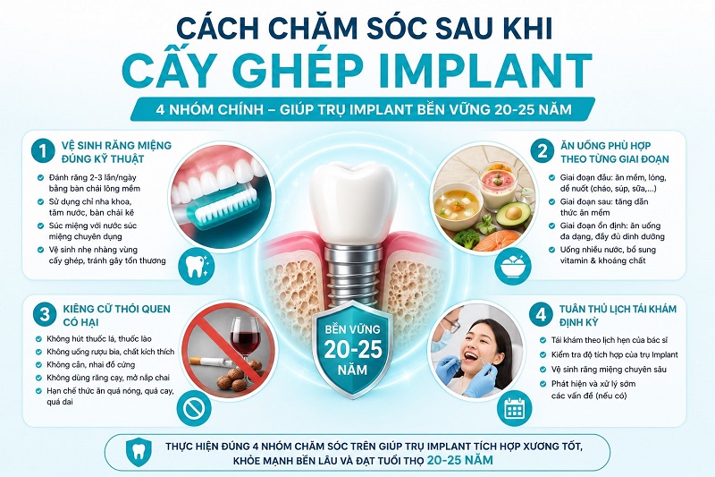 Cách chăm sóc sau khi cấy ghép Implant gồm 4 nhóm chính: vệ sinh răng miệng