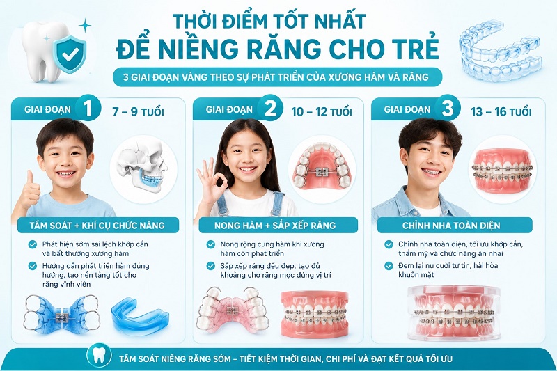 Thời điểm tốt nhất để niềng răng cho trẻ em là từ 7-16 tuổi, chia làm 3 giai đoạn vàng: