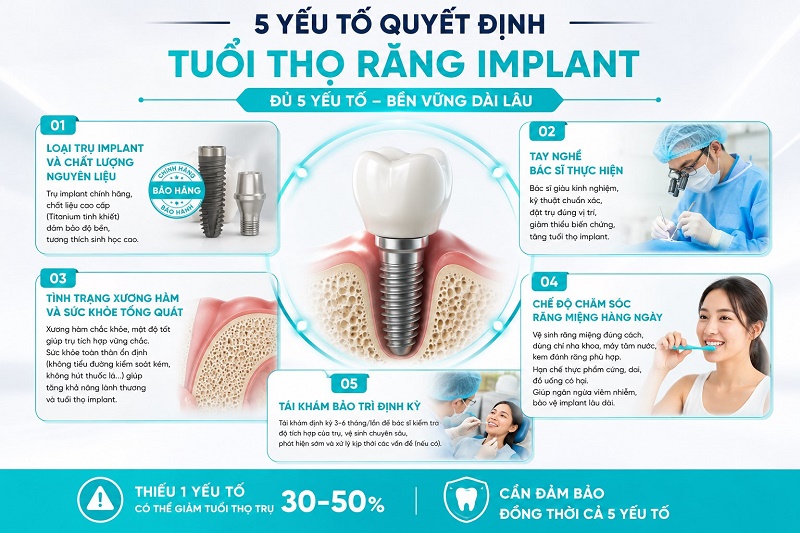 yếu tố quyết định tuổi thọ răng Implant gồm: loại trụ Implant và chất lượng nguyên liệu, tay nghề bác sĩ thực hiện, tình trạng xương hàm và sức khỏe tổng quát, chế độ chăm sóc răng miệng hàng ngày