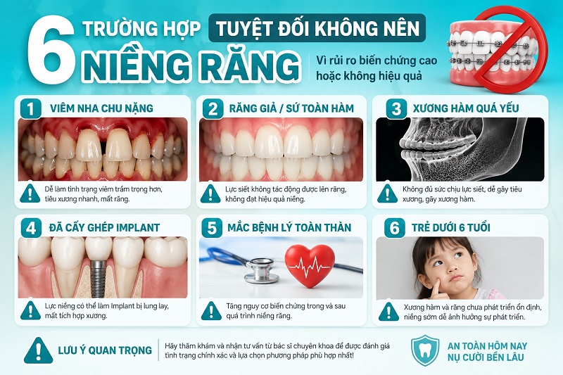Có 6 trường hợp tuyệt đối KHÔNG NÊN niềng răng vì rủi ro biến chứng cao hoặc không hiệu quả: