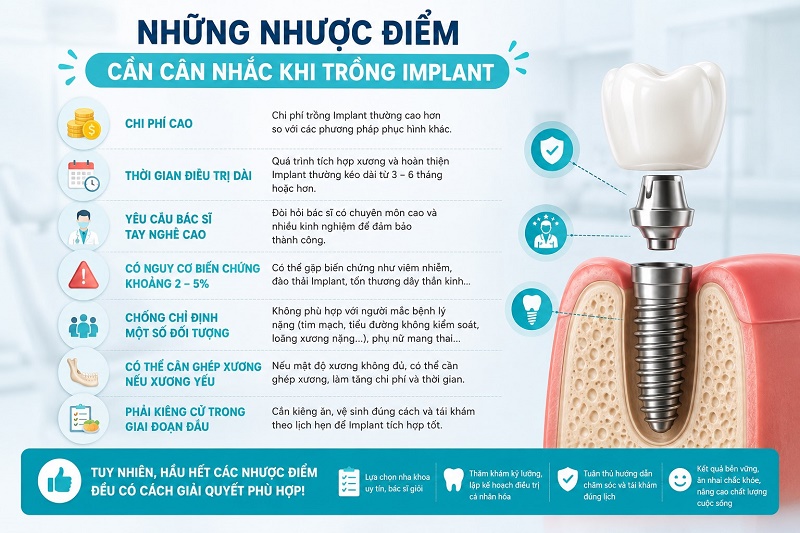 những nhược điểm cần cân nhắc khi trồng Implant gồm: chi phí cao , thời gian điều trị dài, yêu cầu bác sĩ tay nghề cao