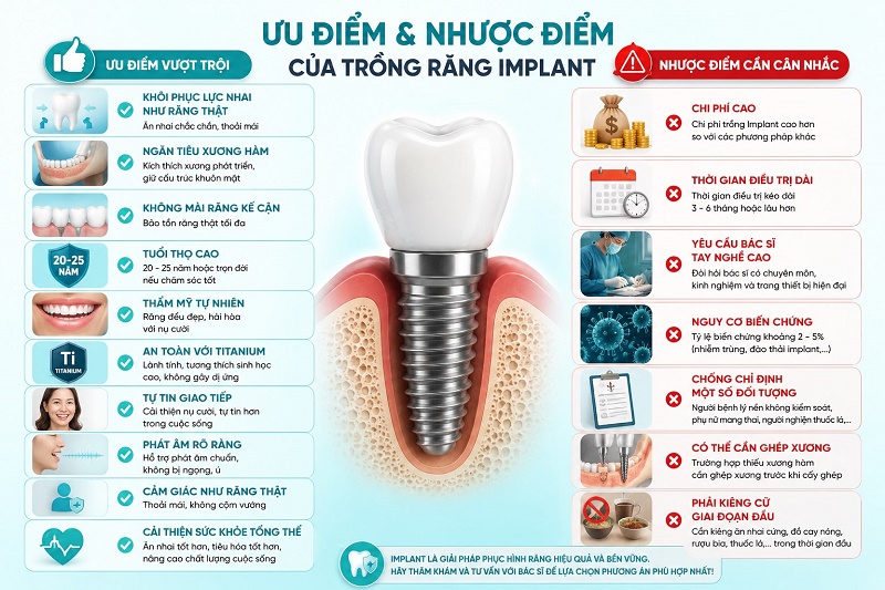ưu điểm vượt trội của trồng răng Implant gồm: khôi phục lực nhai , ngăn tiêu xương hàm, không mài răng kế cận