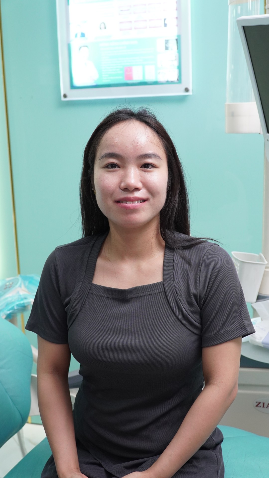 Chị Bích trước khi bọc răng sứ thẩm mỹ tại Nha khoa Smile One cơ sở Hà Đông