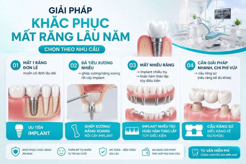 Dù đã mất răng lâu năm, anh Hùng vẫn có thể phục hồi răng để cải thiện thẩm mỹ, ăn nhai và hạn chế