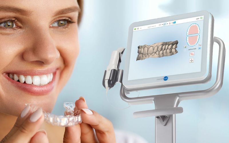 Công nghệ lấy dấu iTero Element 5D có nhiều điểm ưu việt