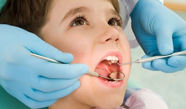 Trẻ em dưới 18 tuổi không nên bọc răng sứ