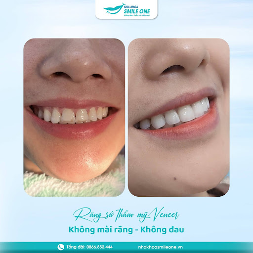 Case khách hàng thực tế tại Smile One