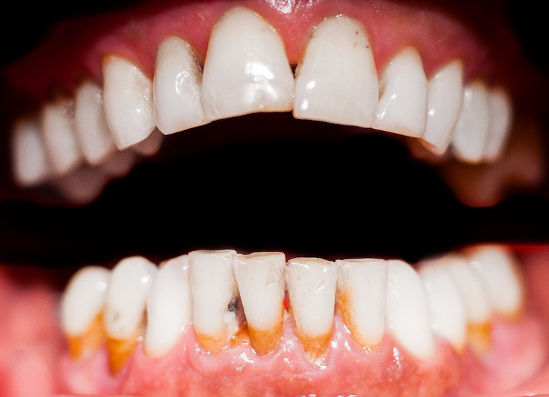 Có rất nhiều người mắc bệnh lý răng miệng