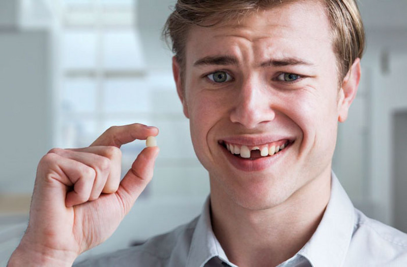 Khi gãy răng cần thăm khám để đánh giá tình trạng và xử lý phù hợp