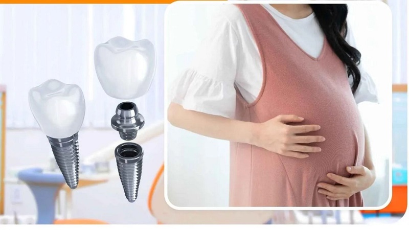 Bà bầu bị mất răng nên giữ vệ sinh răng miệng sạch sẽ,