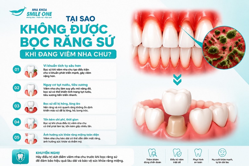 Không nên bọc răng sứ khi đang viêm nha chu vì nướu và xương quanh răng còn yếu