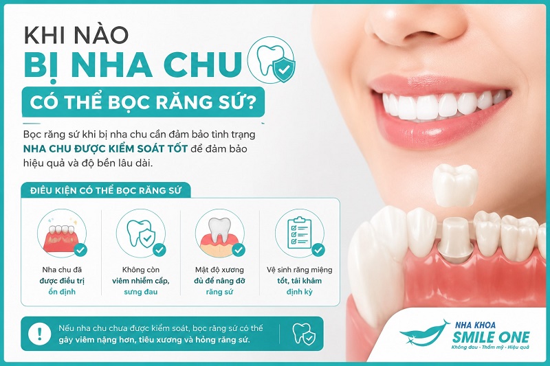 Bị nha chu chỉ có thể bọc răng sứ khi tình trạng viêm nướu, chảy máu, tiêu xương hoặc lung lay răng