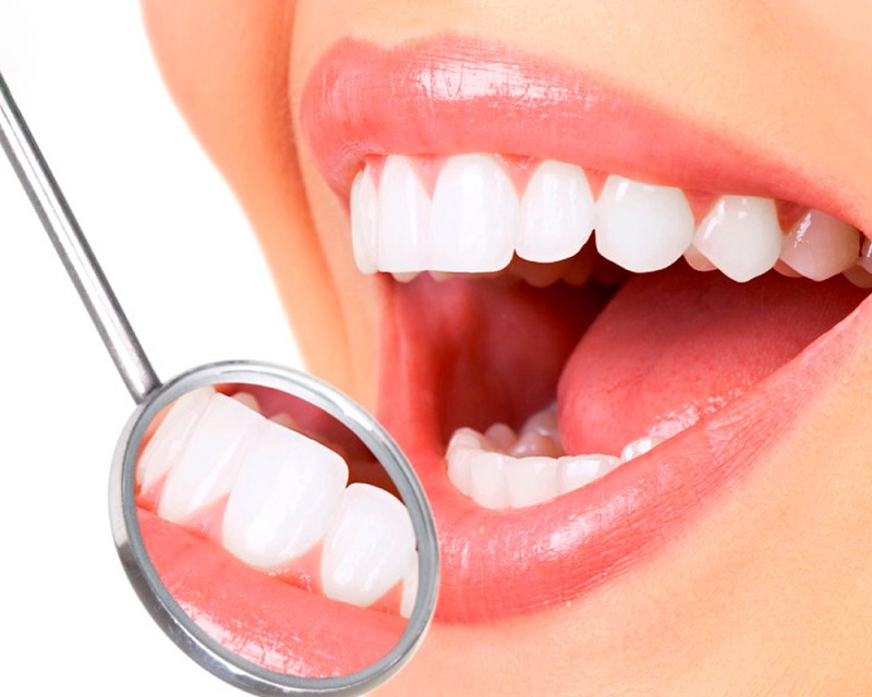 cần niềng răng hoặc phẫu thuật hàm, vì mão sứ không điều chỉnh được xương.