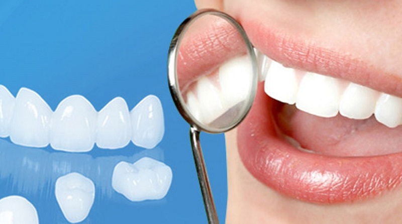 Bọc răng sứ không ảnh hưởng xấu đến sức khỏe nếu răng được kiểm tra kỹ