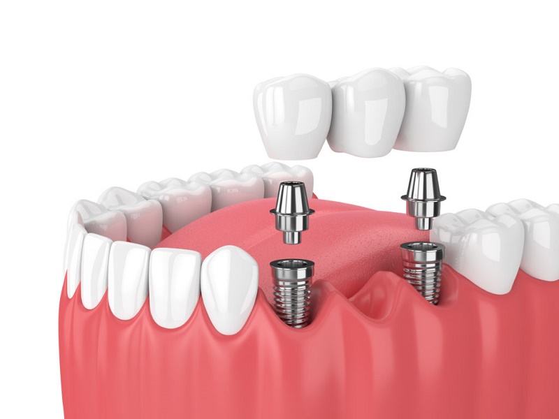 Một số dấu hiệu cho thấy quá trình đang diễn ra thuận lợi.