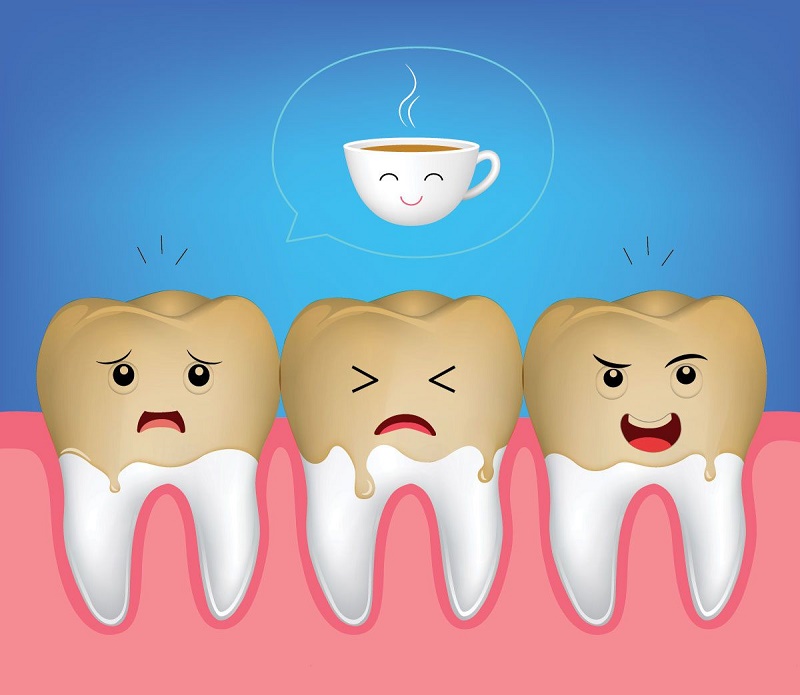 còn răng toàn sứ chất lượng tốt thường ít đổi màu hơn.
