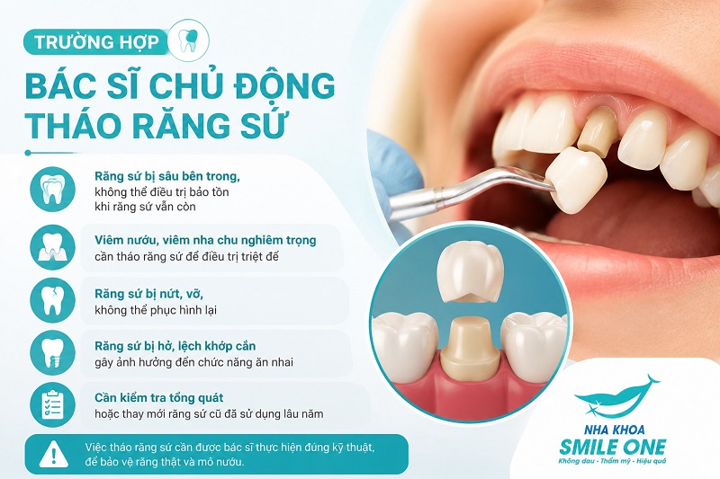 Trường hợp bác sĩ chủ động tháo răng sứ, mão sứ cũ gần như không thể lắp lại