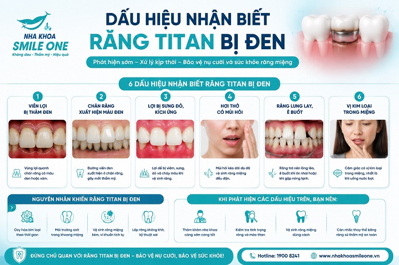Dấu hiệu nhận biết răng sứ Titan bị đen là xuất hiện viền đen hoặc xám ở sát nướu,