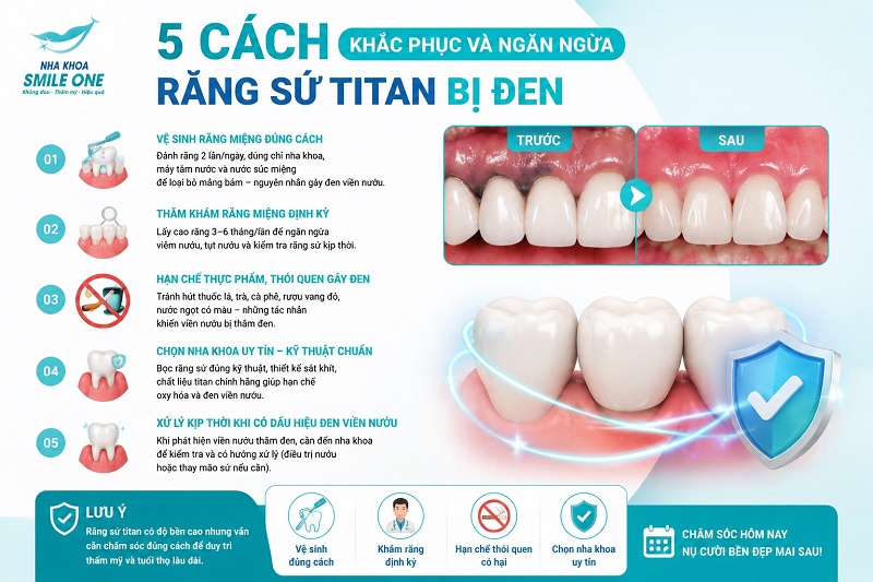 5 cách khắc phục và ngăn ngừa răng sứ titan bị đen
