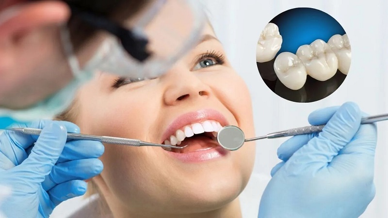 Vita là hãng vật liệu sứ của Đức, không phải một loại răng sứ duy nhất