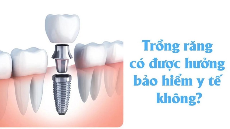 BHYT thanh toán theo quy định khi thực hiện đúng tuyến, tại cơ sở có nhận bảo hiểm y tế.