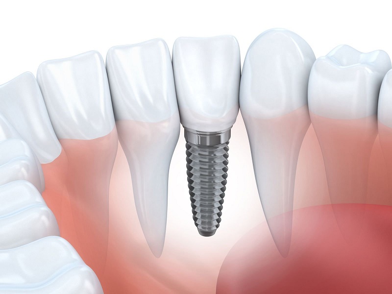 Ranh giới nằm ở mức độ và thời gian kéo dài của cơn đau.