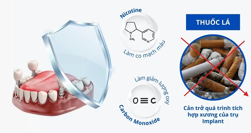 Ăn thịt bò sau cấy Implant cần lưu ý chọn thịt mềm, cắt nhỏ và nhai nhẹ nhàng