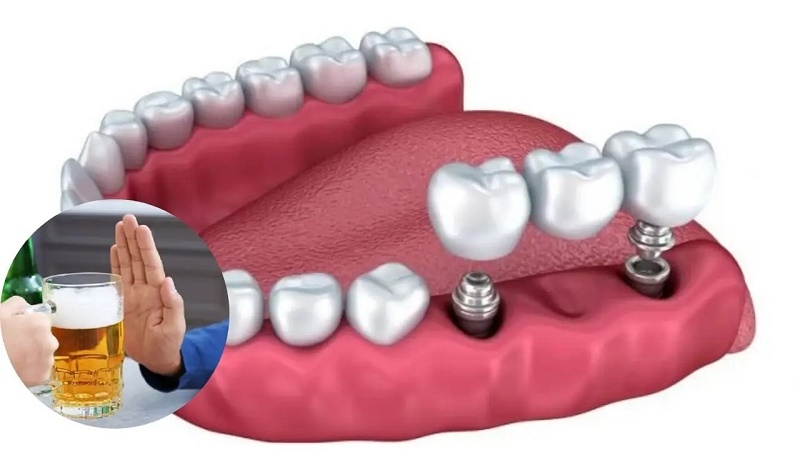 kiêng hẳn rượu bia trong 2 tuần đầu và hạn chế tối đa