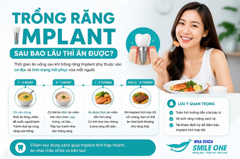 không nên ăn ngay sau khi mới trồng răng, chỉ nên ăn các loại thức ăn dạng lỏng,