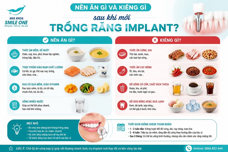 Trong 1–2 tuần đầu sau khi trồng Implant, người mới cấy trụ