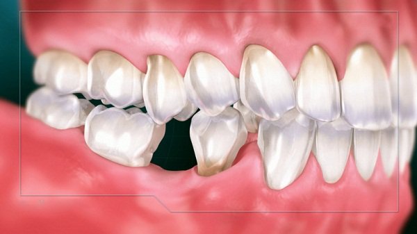 tinh thần chung của các mẹo dân gian là giảm đau và giảm sưng