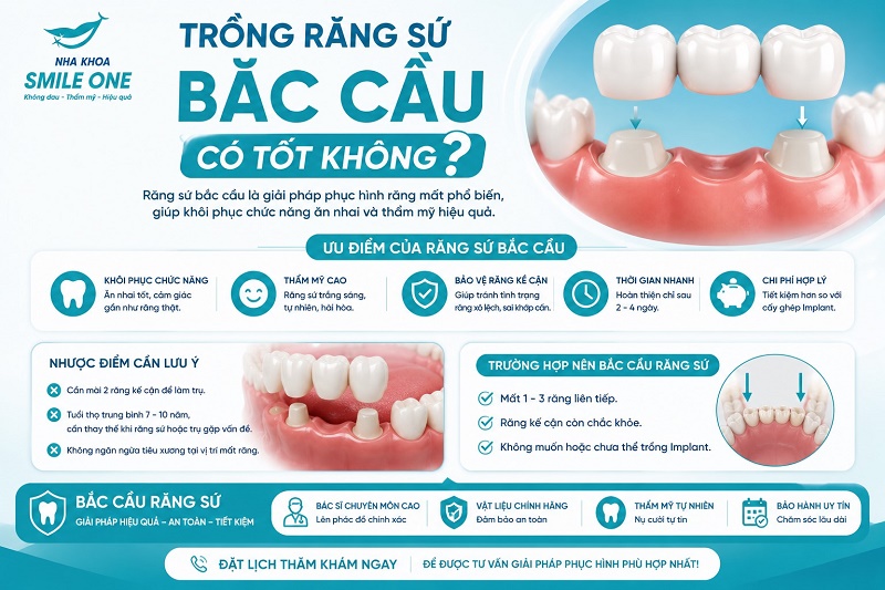Trồng răng sứ bắc cầu là phương pháp phục hình tốt nếu mất 1–2 răng,
