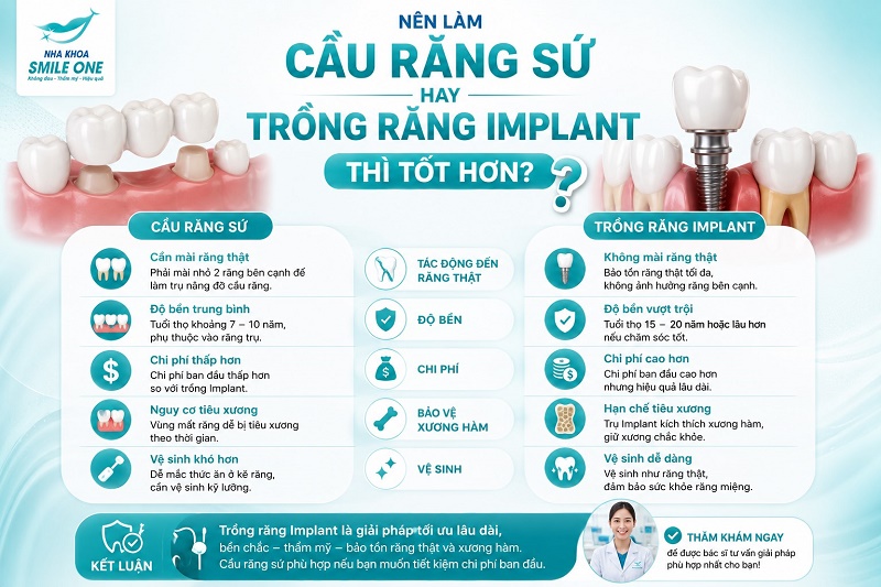 Trồng răng Implant thường tốt hơn cầu răng sứ nếu bạn muốn bảo tồn