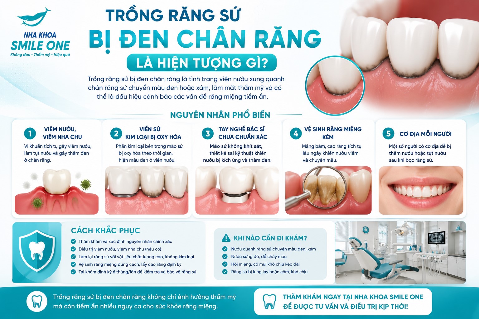 Trồng răng sứ bị đen chân răng là hiện tượng viền nướu