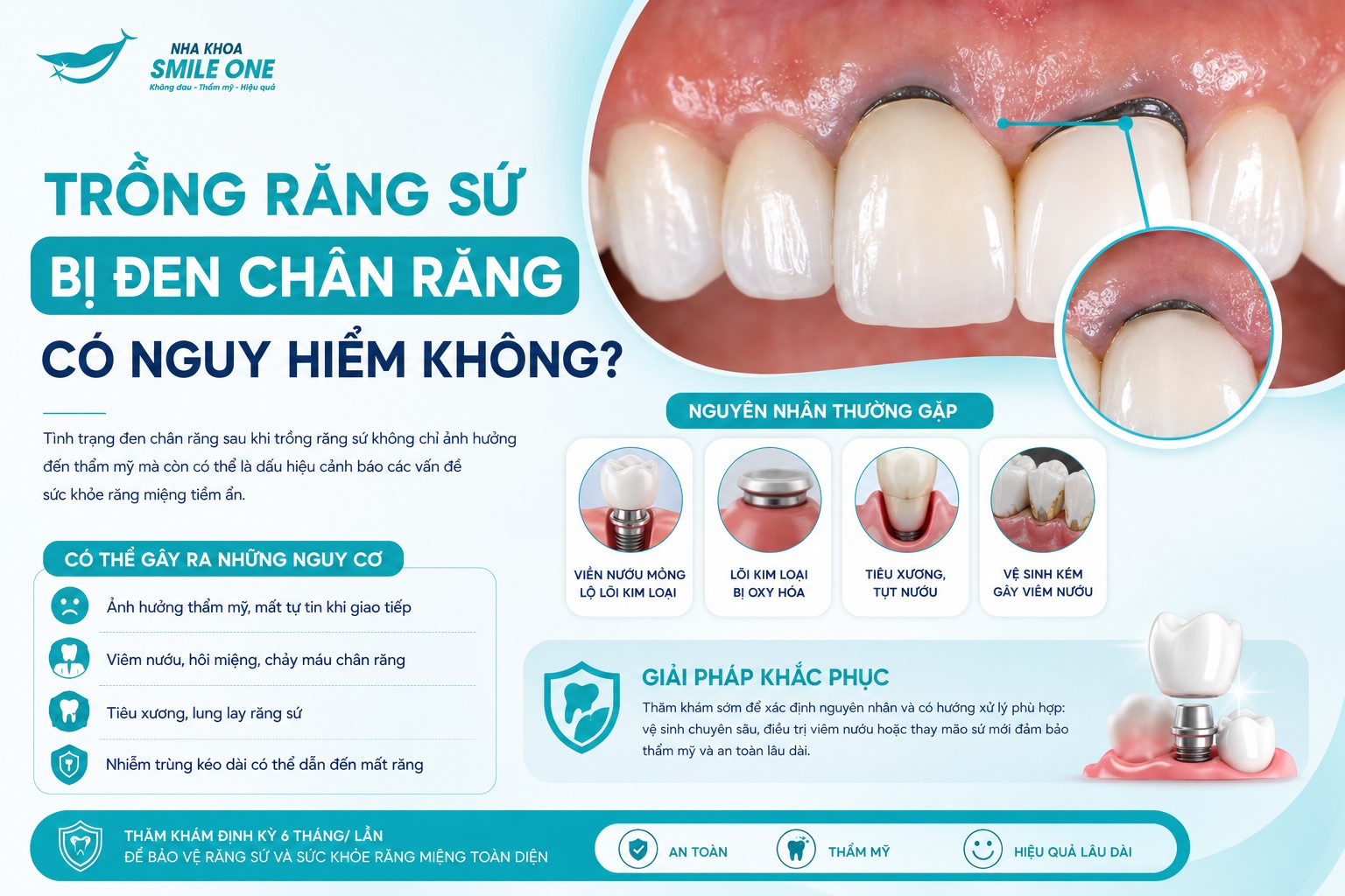 Trồng răng sứ bị đen chân răng thường không nguy hiểm đến tính mạng,