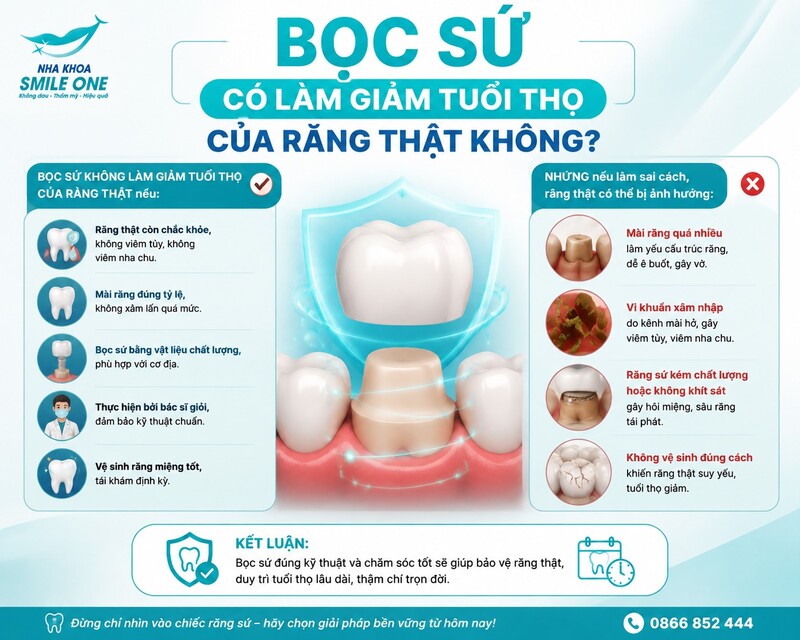 Mão sứ bao phủ phần thân răng nên bác sĩ cần sửa soạn một lượng mô răng nhất định