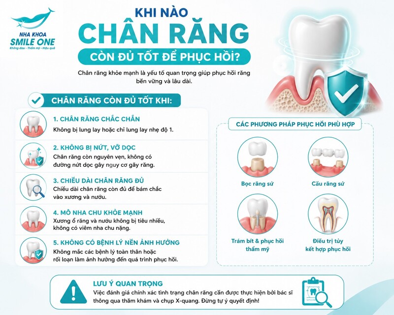 Chân răng được xem là còn khả năng phục hồi khi cấu trúc chân còn nguyên