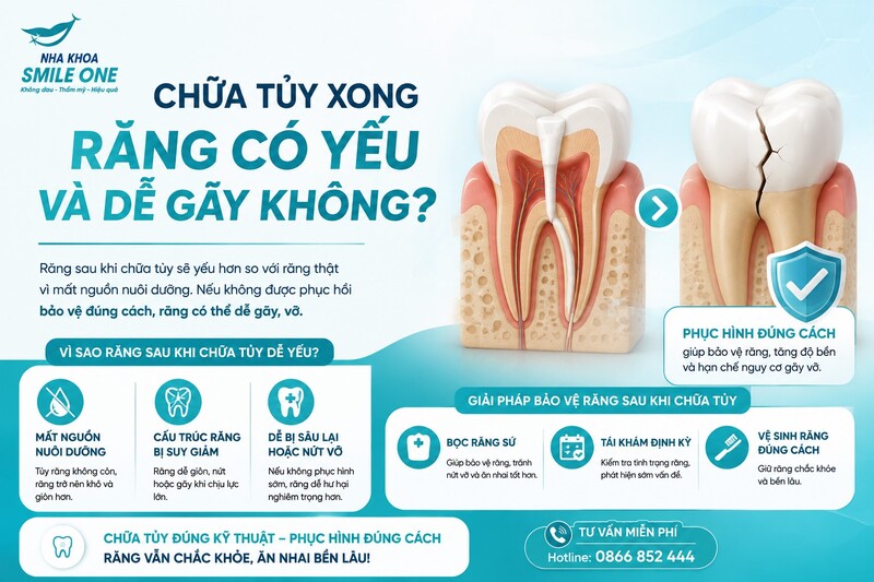 Răng sau chữa tủy có thể có nguy cơ nứt hoặc vỡ cao hơn nếu đã mất nhiều cấu trúc