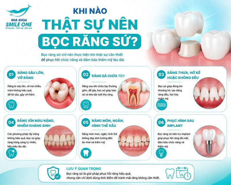 Nếu răng vẫn khỏe và vấn đề chủ yếu là màu sắc, hình dáng hoặc khoảng thưa nhẹ