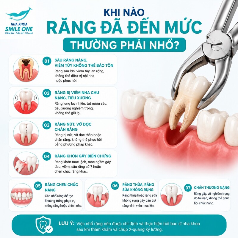 Nhổ răng thường trở thành lựa chọn cần thiết khi chiếc răng không