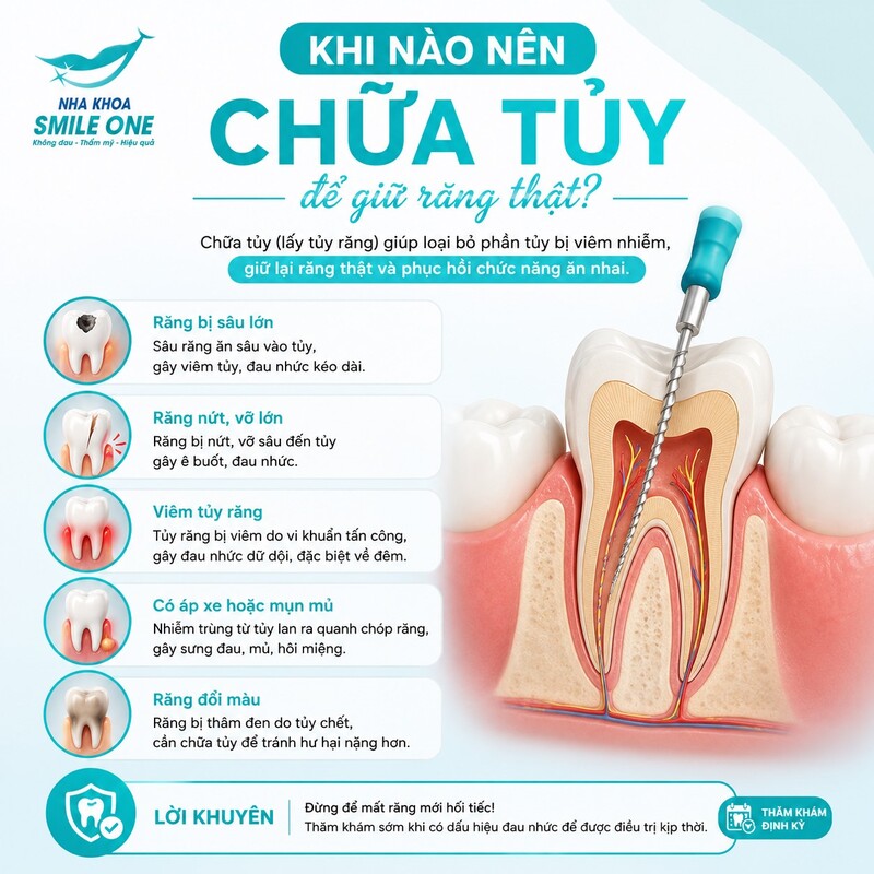 Chữa tủy thường được ưu tiên khi tủy không còn khả năng hồi phục