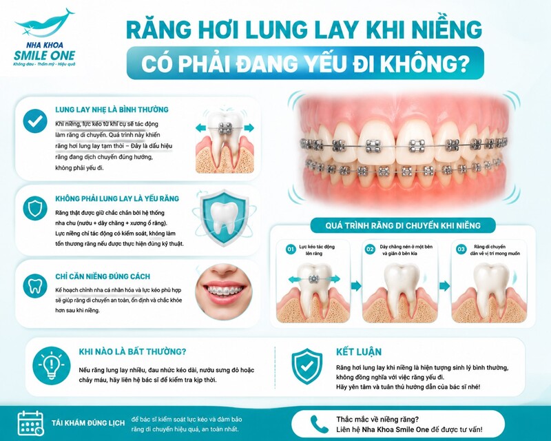 Răng hơi di động trong giai đoạn đang được chỉnh nha có thể xuất hiện