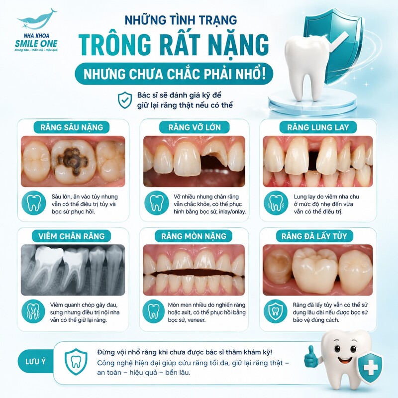 Sâu lớn, đau dữ dội, viêm tủy, tủy hoại tử, áp xe hoặc thân răng vỡ nhiều