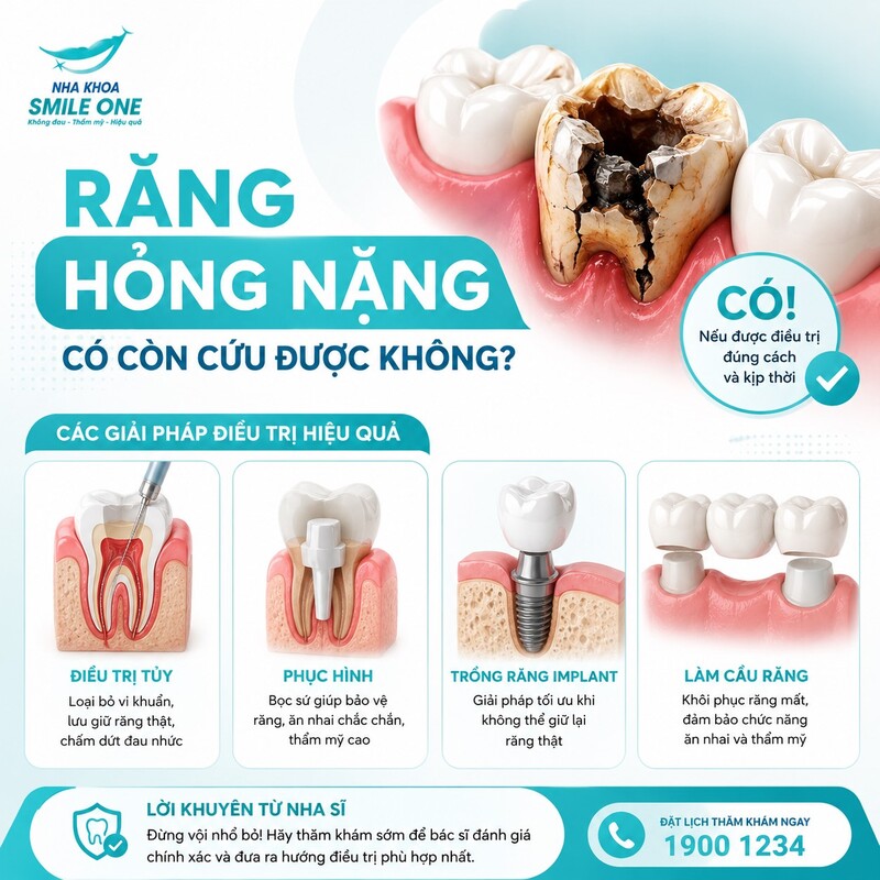 Có thể. Một chiếc răng trông hỏng khá nhiều vẫn có thể cứu nếu chân răng