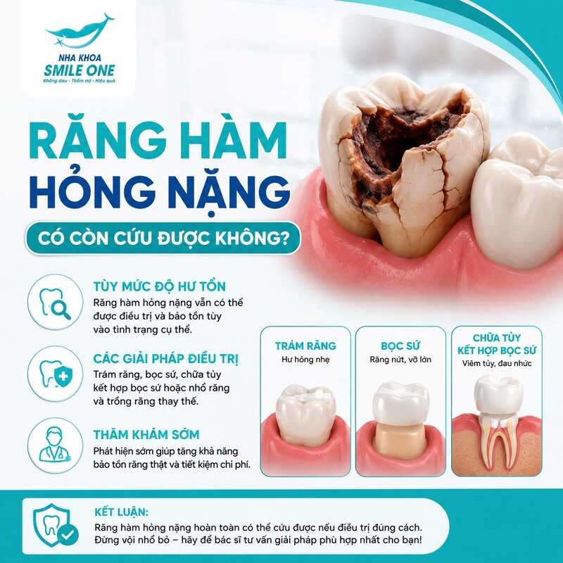 Không có một mốc cố định như “vỡ quá một nửa” hay “hỏng trên 2/3”