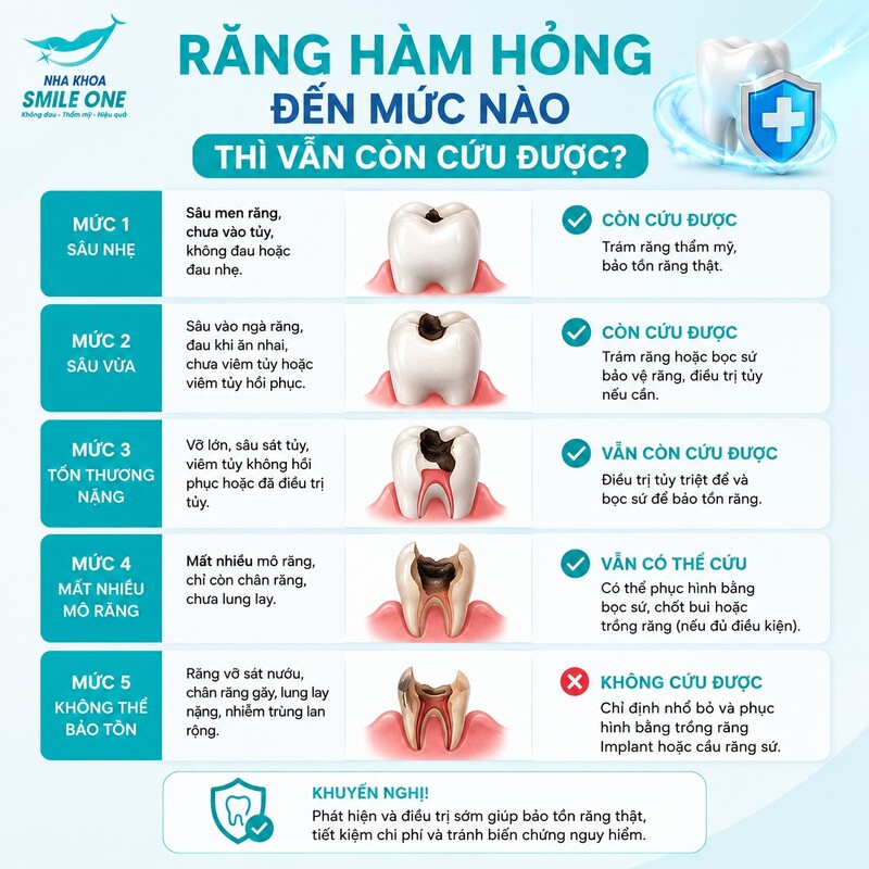 Có thể. Một chiếc răng hàm sâu hoặc vỡ khá nhiều vẫn có thể giữ lại