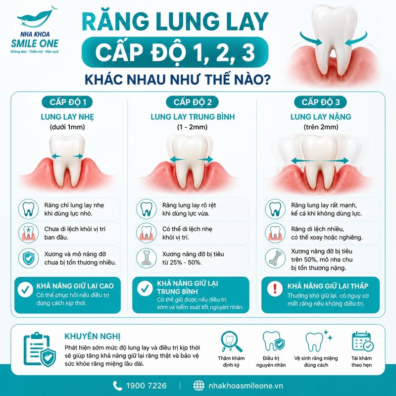 Răng độ 2 vẫn có thể giữ vì cấp độ lung lay mới chỉ cho biết mức mất ổn định của răng